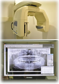 デジタルパノラマレントゲン撮影機